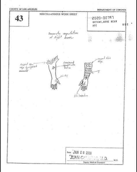 kobe autopsy gigi|File : Gianna Bryants autopsy report (2020).pdf